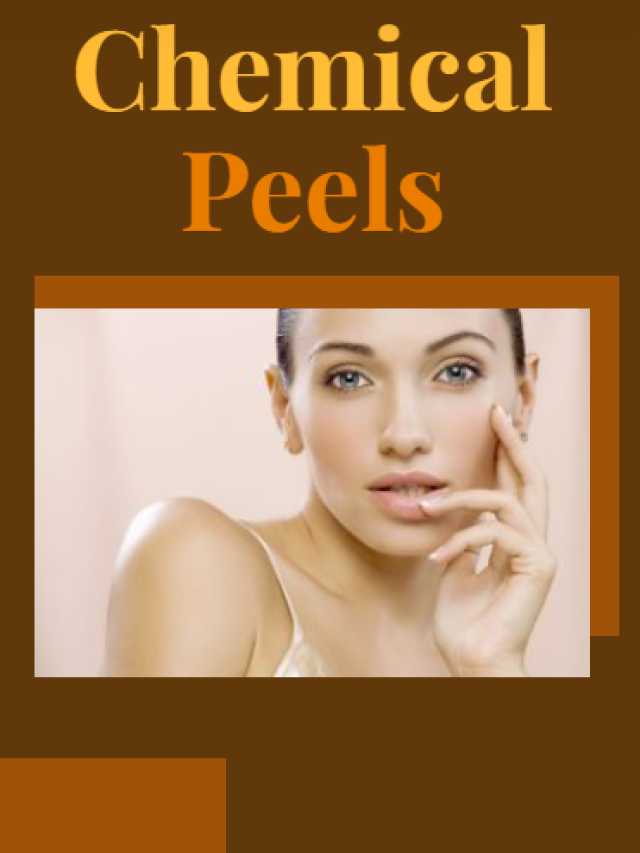 Chemical Peels