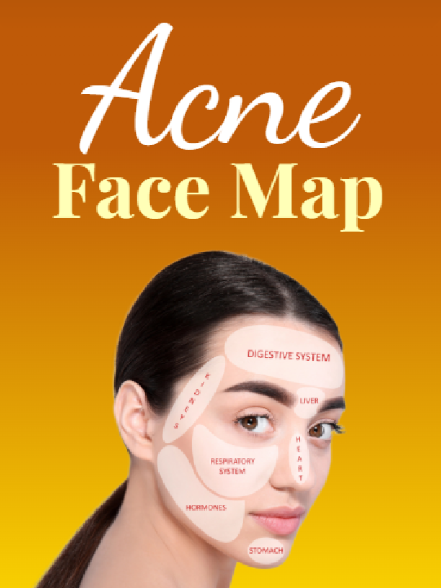 Acne Face Map