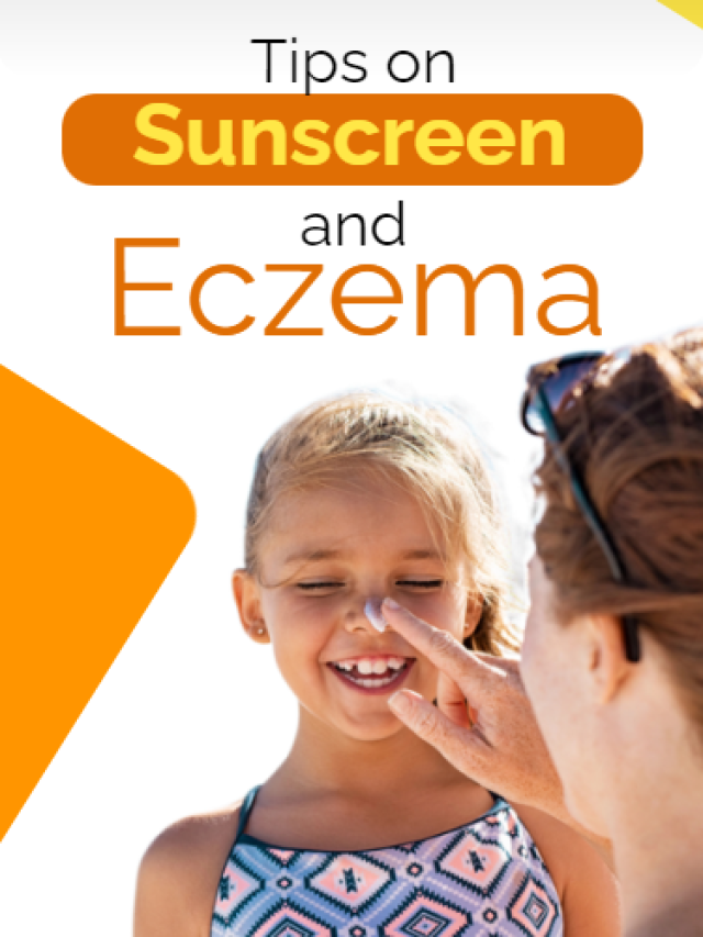 Tips on Sunscreen and Eczema