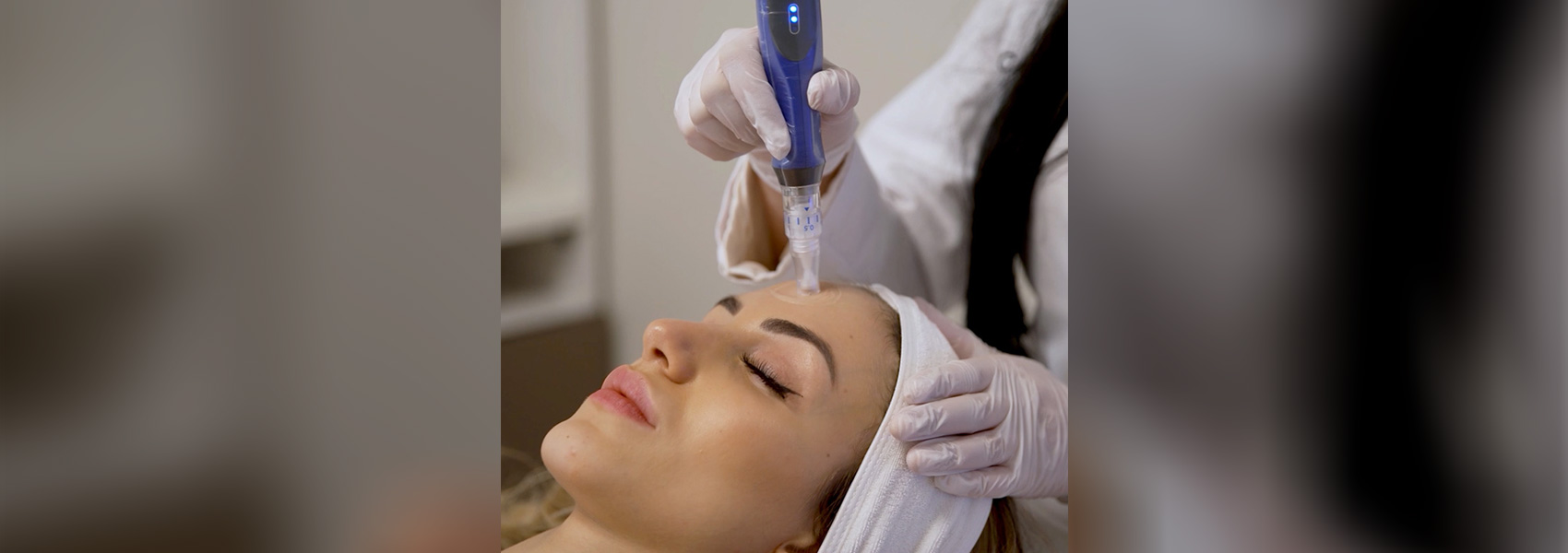Microneedling - Laser Center of Orlando, FL