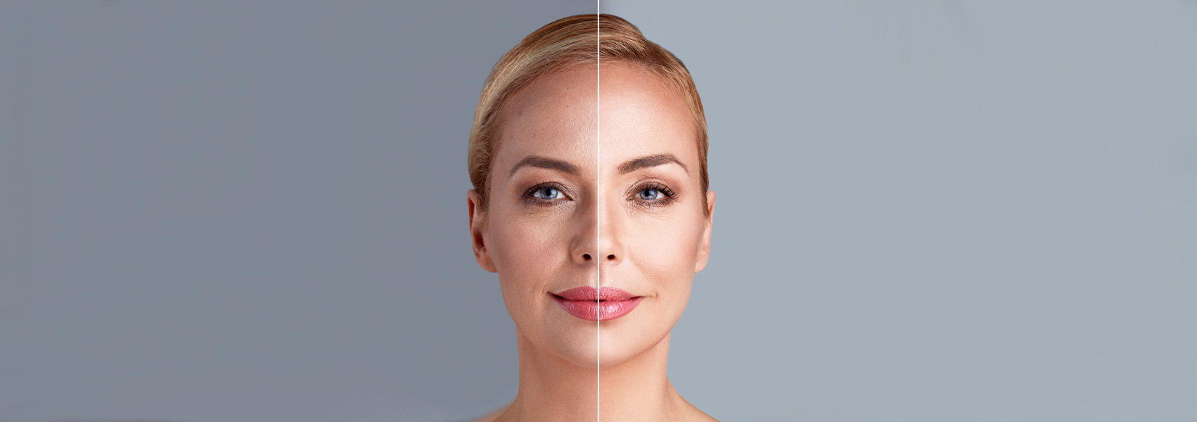Girl's face before and after