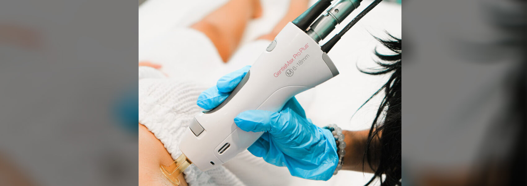 Laser hair removal