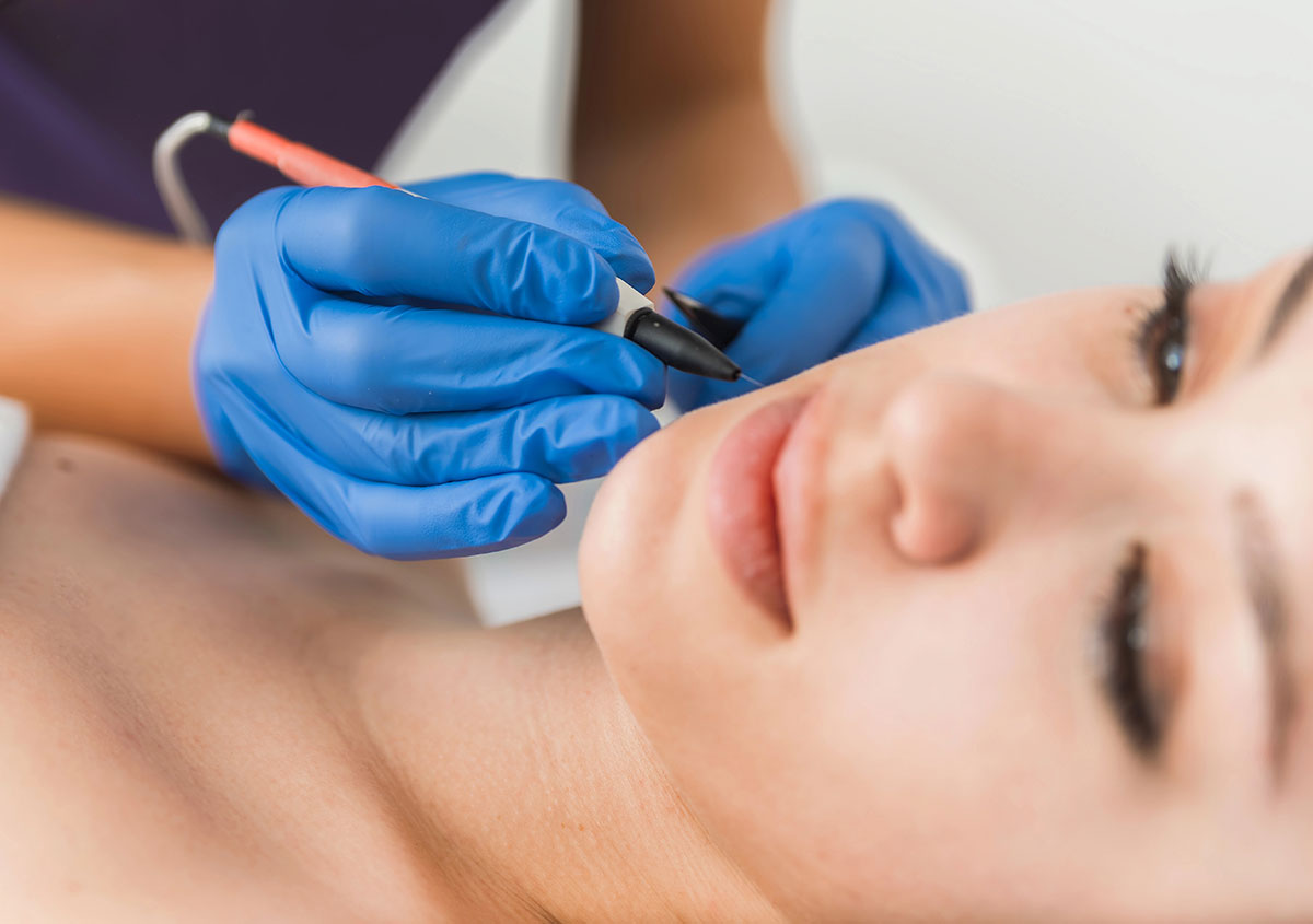 Electrolysis Hair Removal in Orlando area