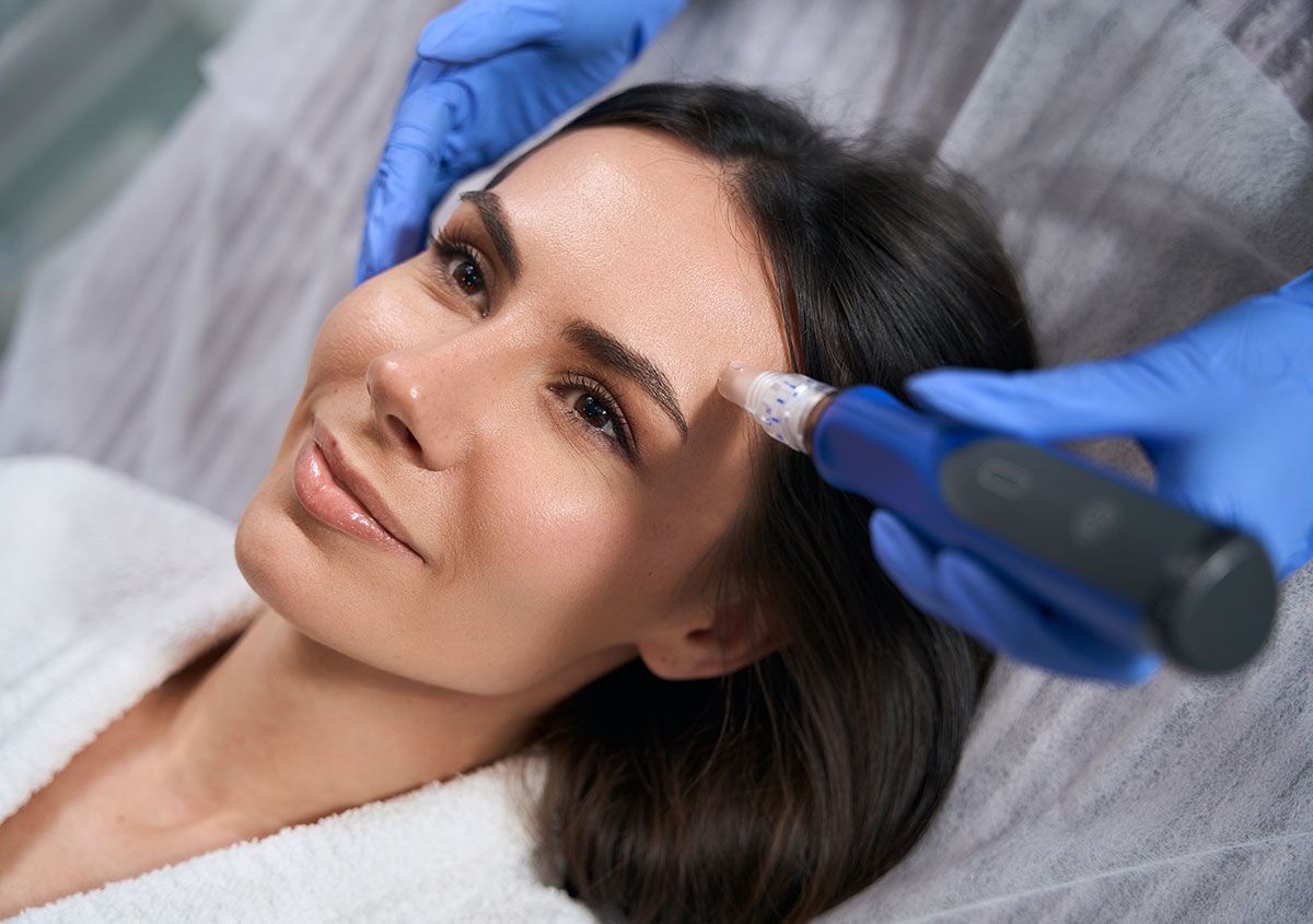 Microneedling Service in Orlando FL Area