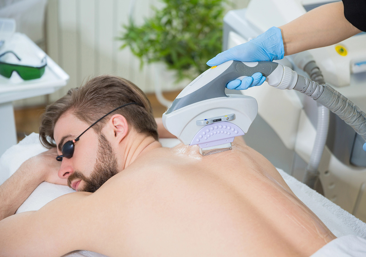 Laser Hair Removal Process in Orlando FL Area