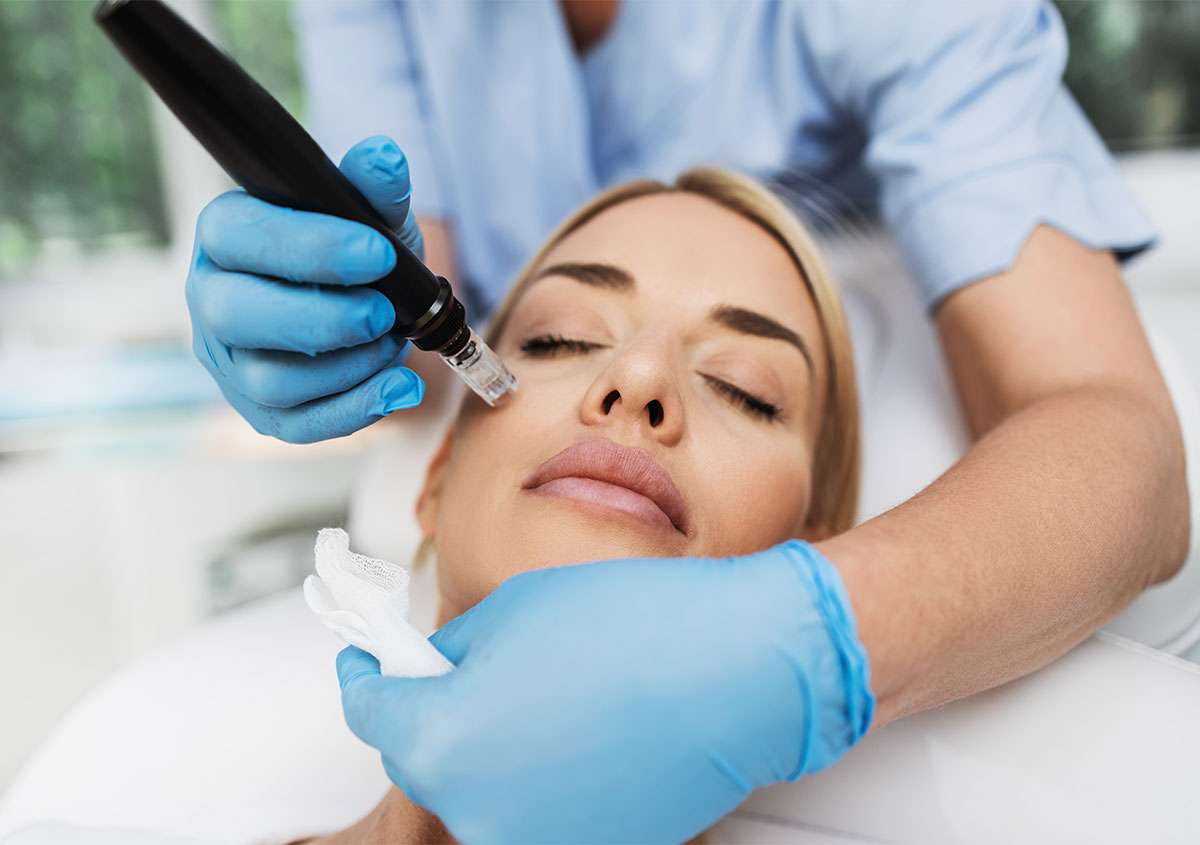 Microneedling Treatment Benefits in Orlando FL Area